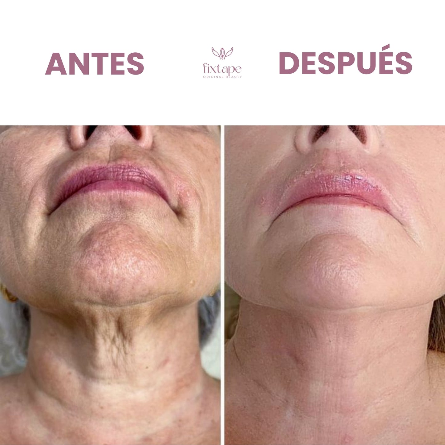 Crema Reafirmante Antiarrugas para Cuello