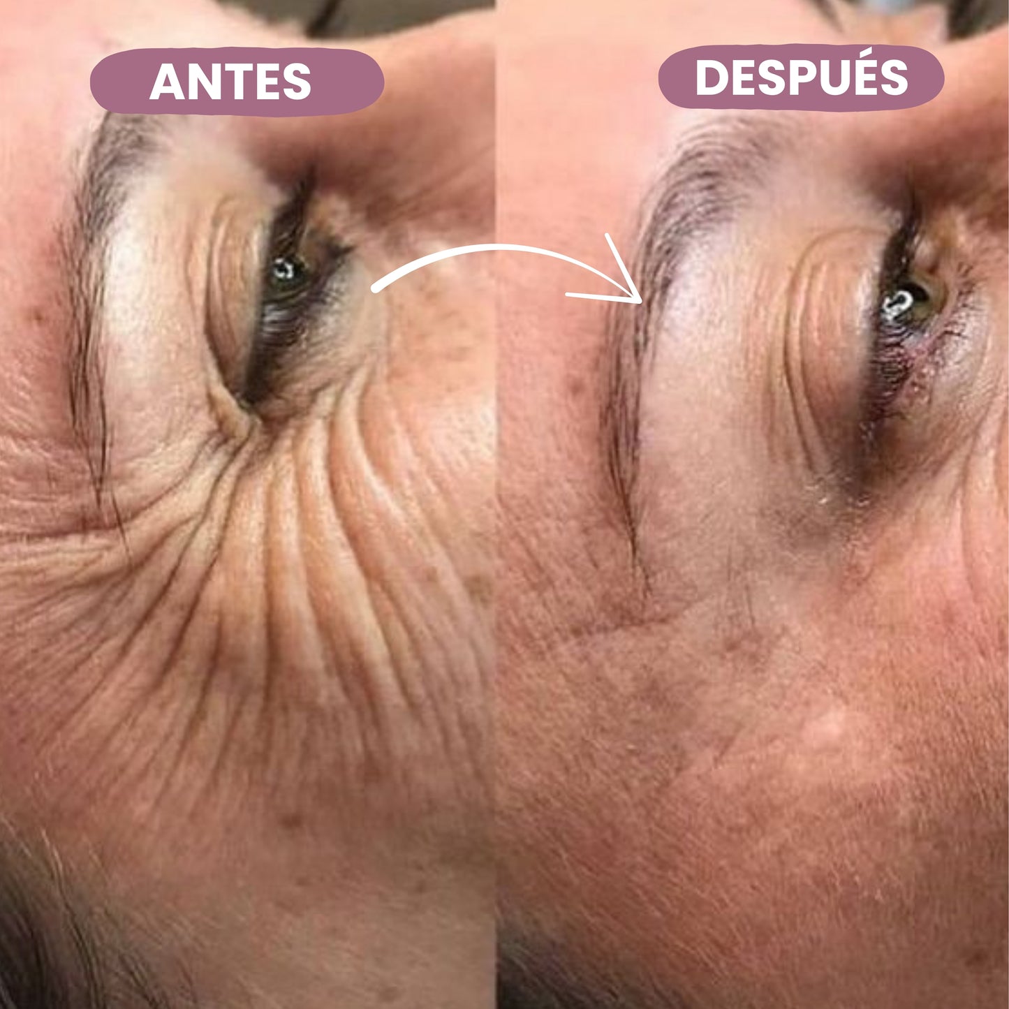 Bálsamo de Calcio Anti-Arrugas - 10gr