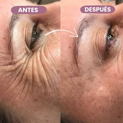 Bálsamo de Calcio Anti-Arrugas - 10gr