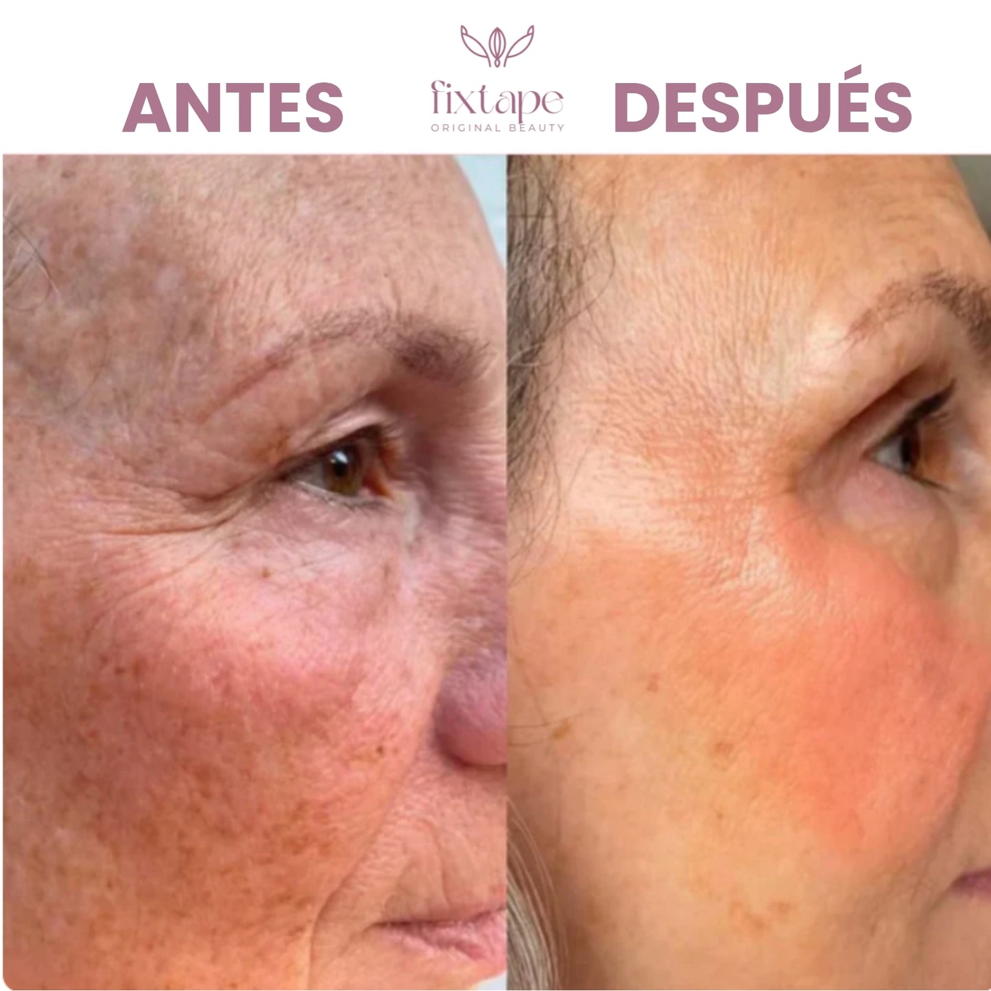 Sérum de Retinol 0.2% Anti arrugas - 30ml