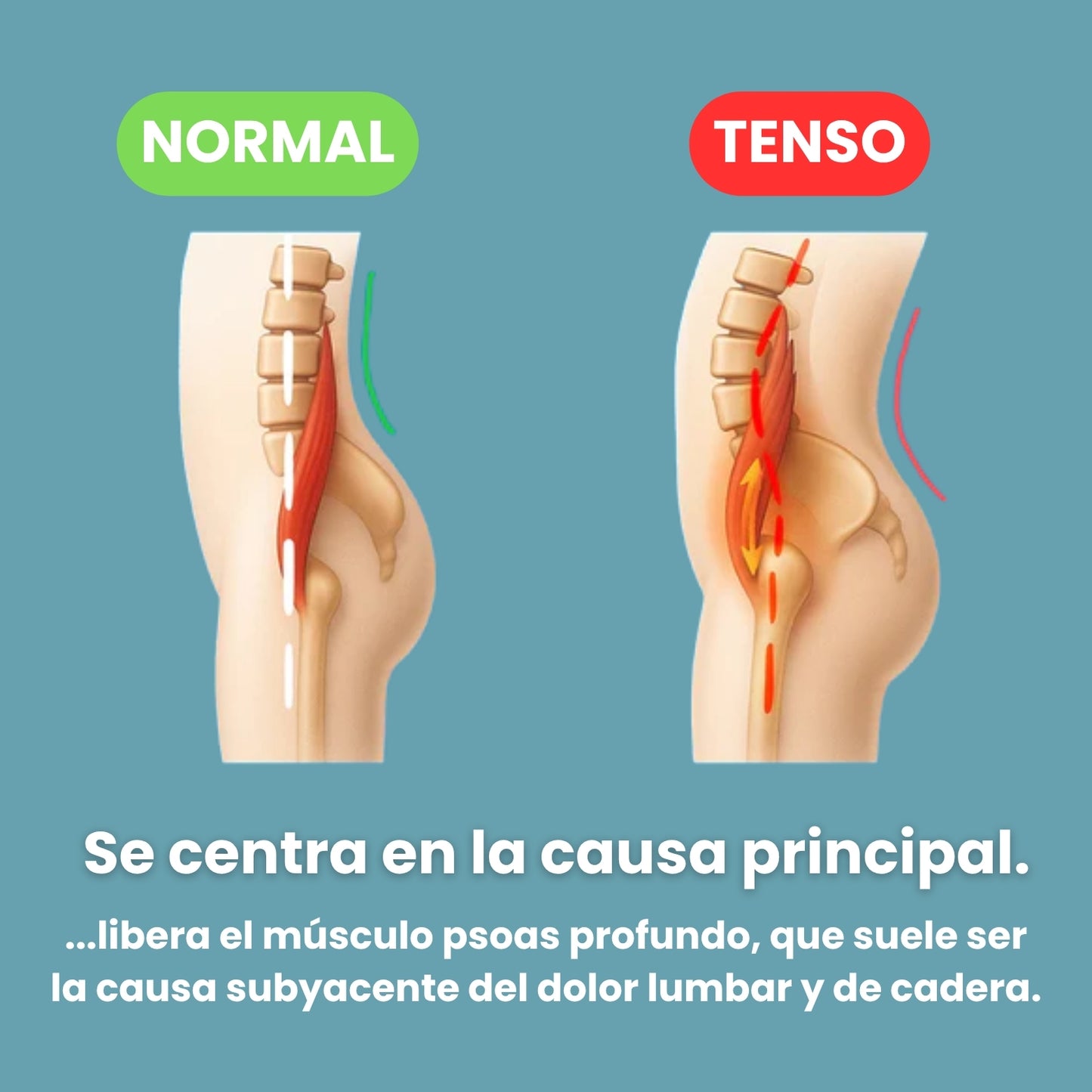 LumbaCare - AntiDolor Lumbar & Cadera